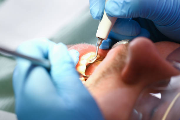 Best Urgent Tooth Repair  in Somerville, MA